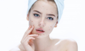 皮肤差毛孔粗大暗沉怎么办 皮肤差毛孔粗大暗沉如何改善？